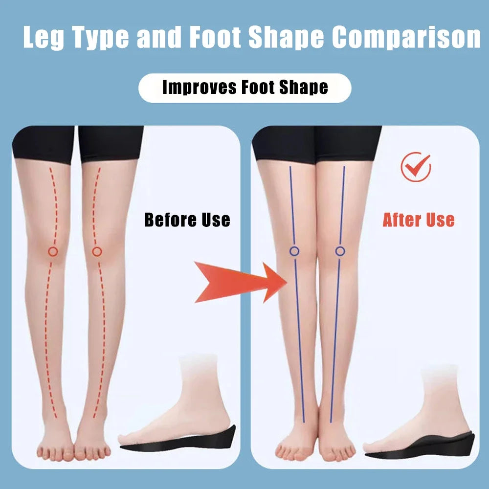 Flat Foot O-Shaped Legs Insole for Shoes Correction Arch Support Plantar Fasciitis Orthopedic Insoles Men/Women Foot Care Insert