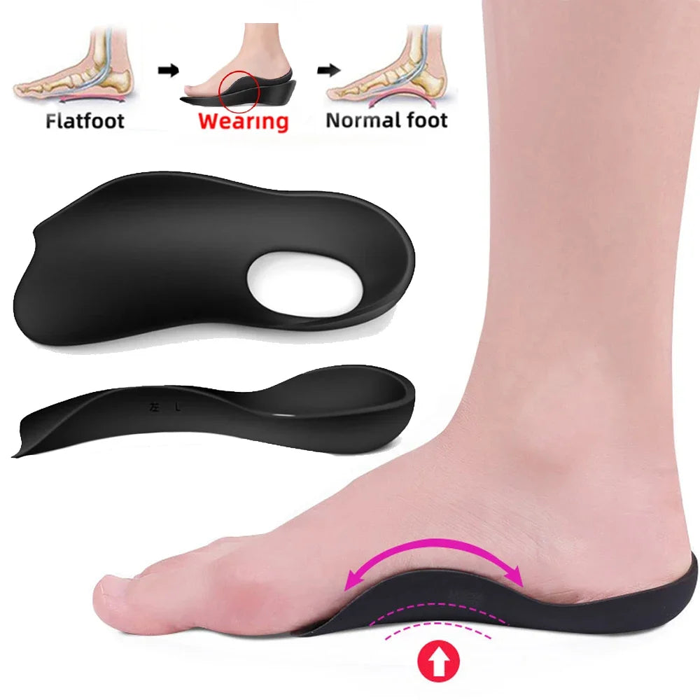 Flat Foot O-Shaped Legs Insole for Shoes Correction Arch Support Plantar Fasciitis Orthopedic Insoles Men/Women Foot Care Insert